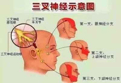 中国好医生—蒋学林  三叉神经痛就服全蝎蜈蚣多肽