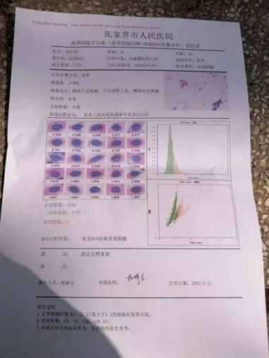 中国著名针灸专家 治疗肿瘤第一人—陈吉香