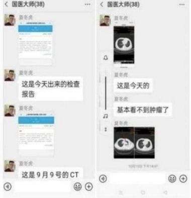 中国著名针灸专家 治疗肿瘤第一人—陈吉香